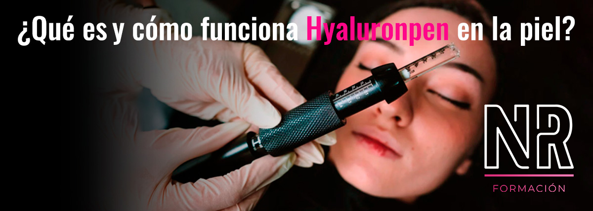 ¿Qué es Hyaluronpen y cómo funciona en la piel?